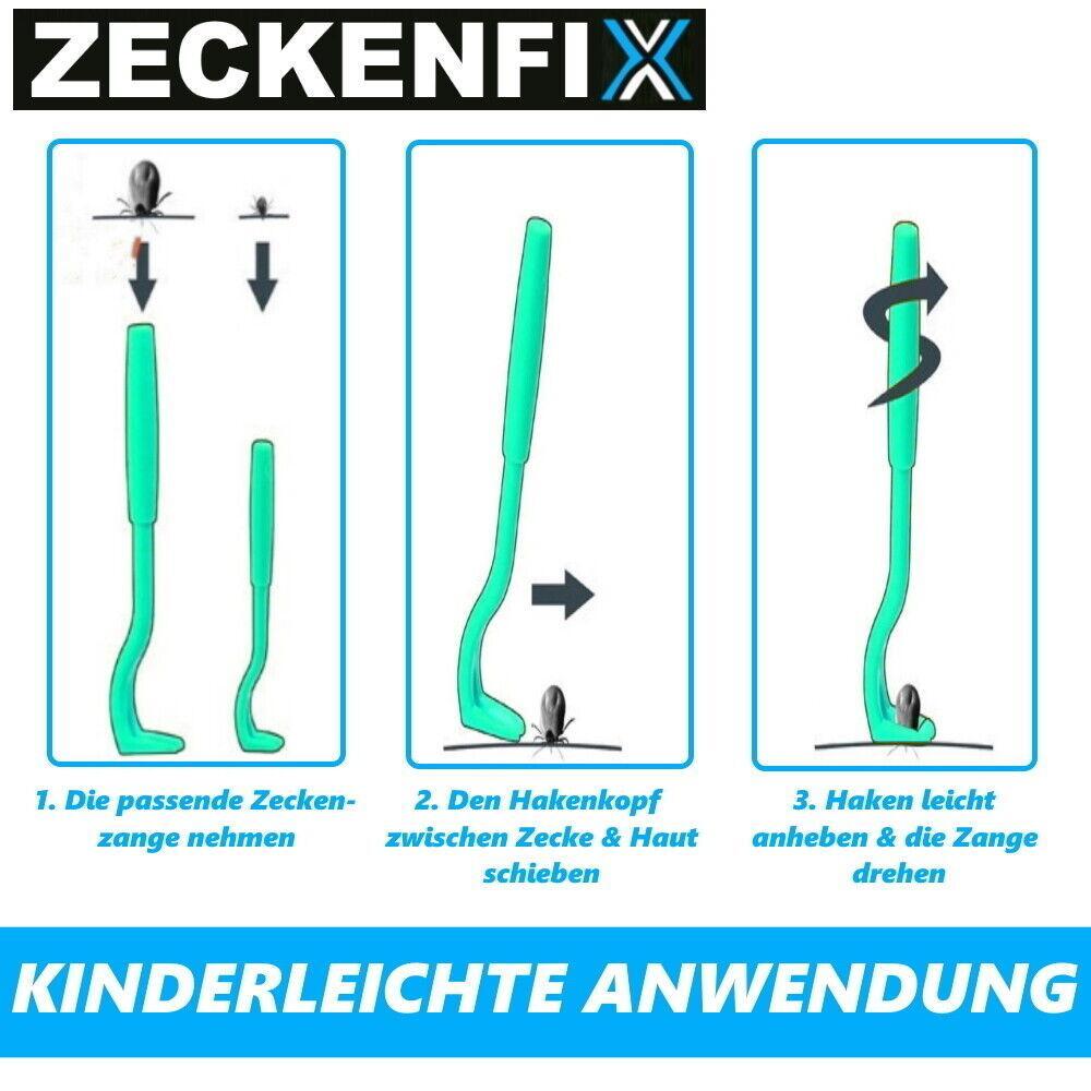 ZECKENFIX Zeckenzange Hunde Katze Zeckenpinzette Zeckenentferner Zeckenhaken Set