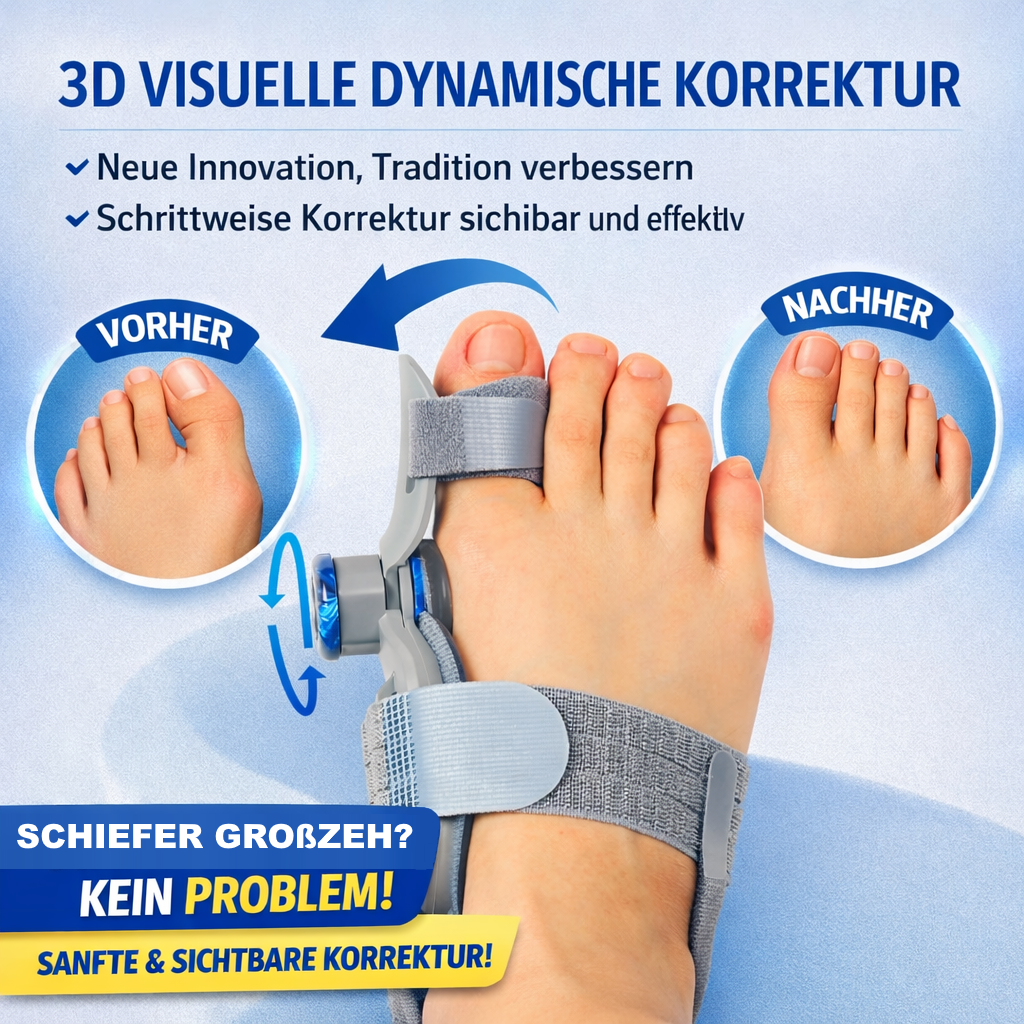 BuniCure™ Hallux Valgus Korrektur Schiene Zehenspreizer Zehenschiene Zehentrenner