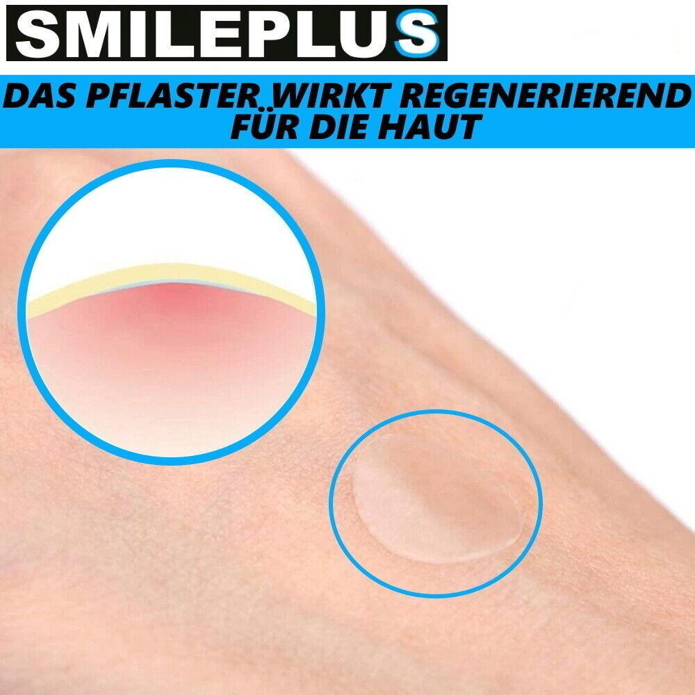 SMILEPLUS XXL Akne Pflaster Set Hydrocolloid Patch Anti Pickel Mitesser 36Stk