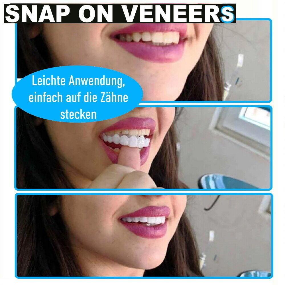 Snap On Veneers Kosmetische Zahnblende Comfort Prothese Falsche Zähne Flex Fit