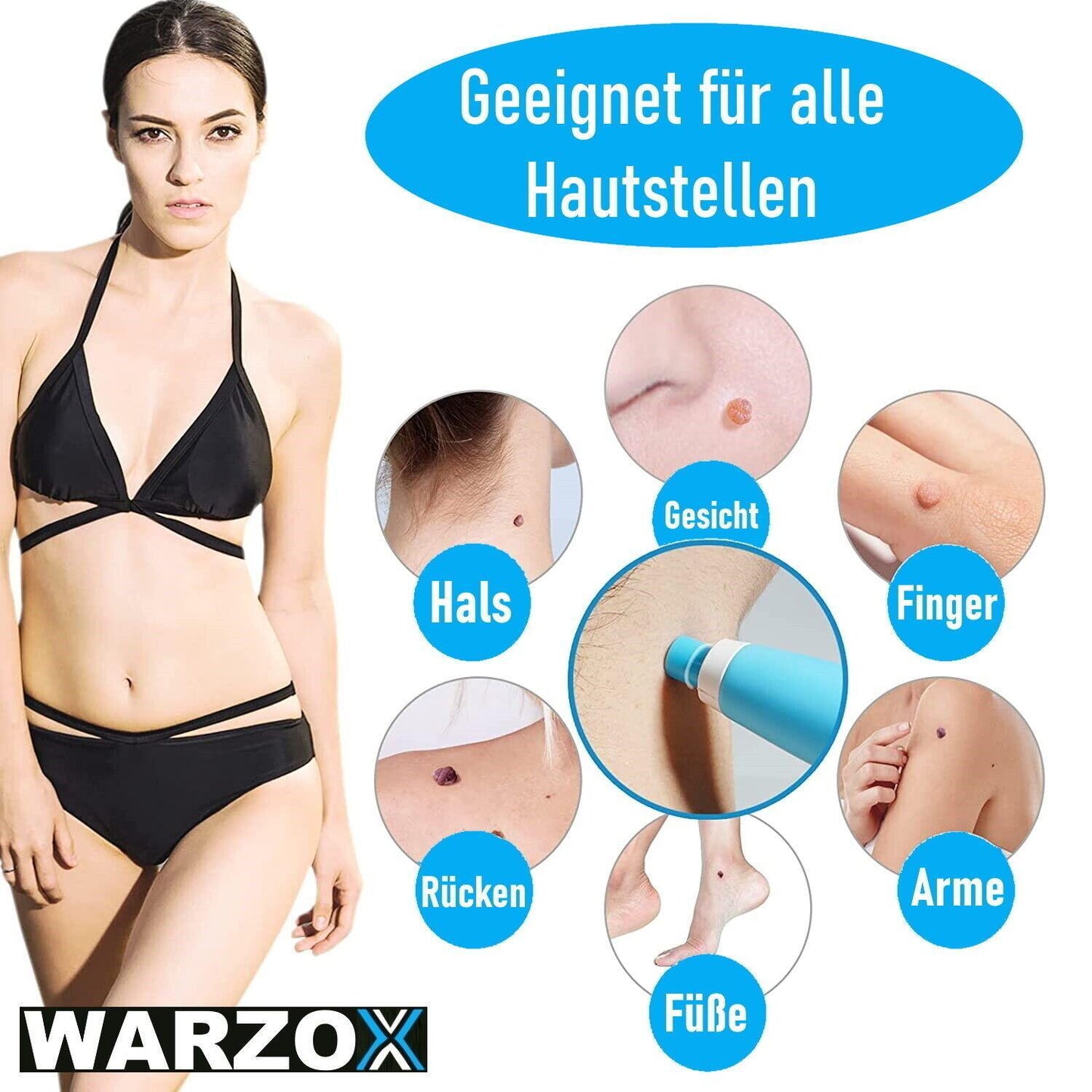 WARZOX Skin Tag Remover Kit Stielwarzen Set Fibrom Kosmetik Entferner 54tlg