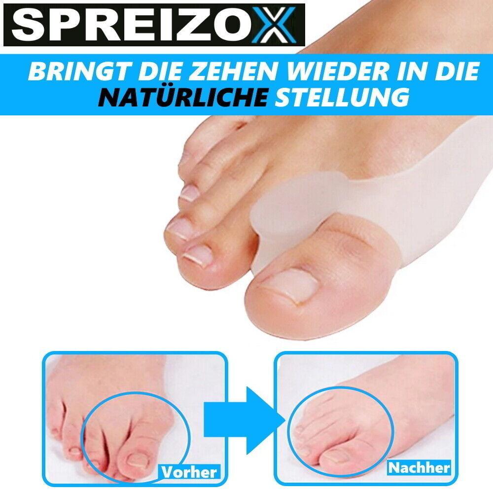 SPREIZOX Zehenspreizer Hallux Valgus Korrektur BPA-Frei Transparent [6 Stück]