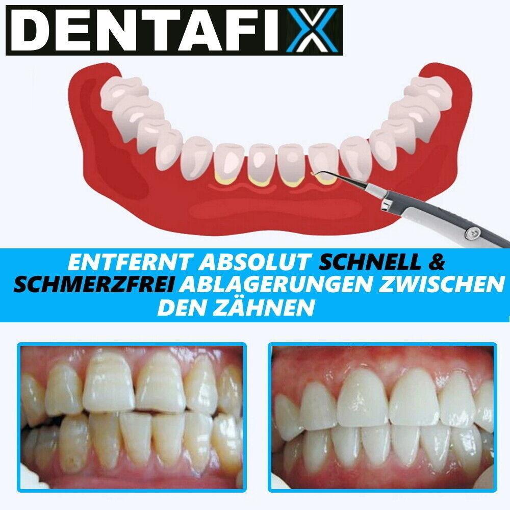 DENTAFIX elektrischer Zahnsteinentferner Zahnpflege Zahnreinigung Plaque Sonic