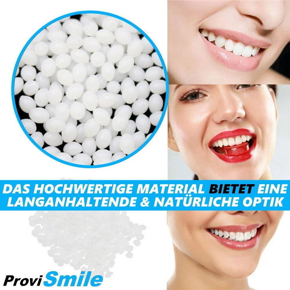 ProviSmile Set provisorischer Zahnersatz Temporärer Zahn Reparatur Lücke Füllung