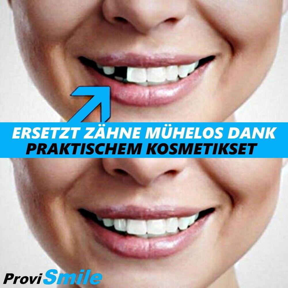ProviSmile Set provisorischer Zahnersatz Temporärer Zahn Reparatur Lücke Füllung