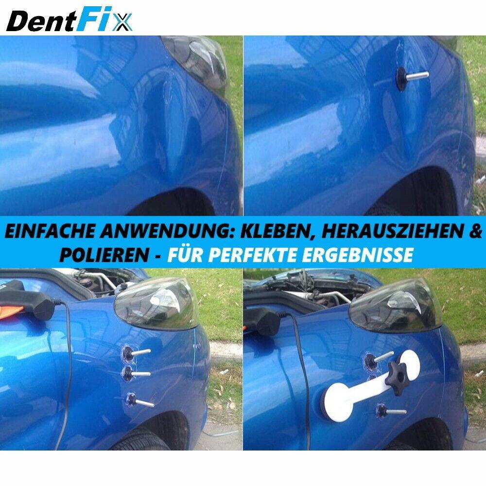 DENTFIX Ausbeulwerkzeug Auto KFZ Beulen Reparaturset Dellenlifter Werkzeug Set