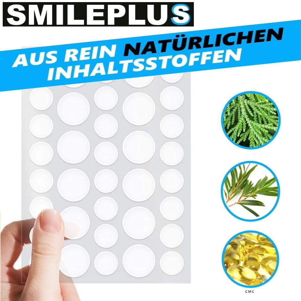 SMILEPLUS XXL Akne Pflaster Set Hydrocolloid Patch Anti Pickel Mitesser 36Stk