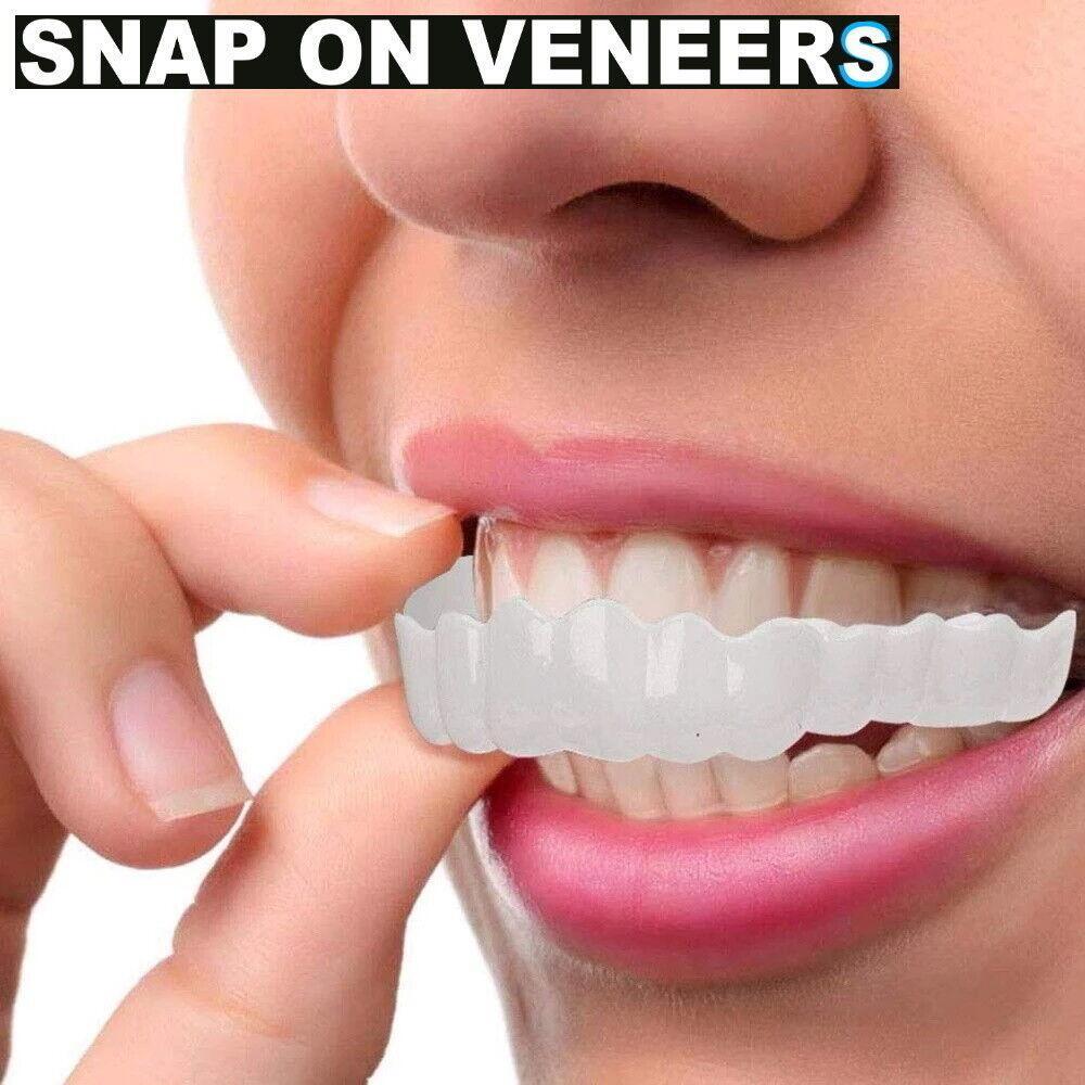Snap On Veneers Kosmetische Zahnblende Comfort Prothese Falsche Zähne Flex Fit