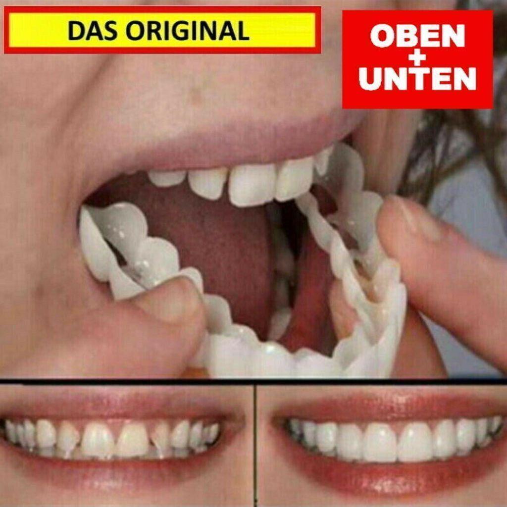 Snap On Veneers Kosmetische Zahnblende Comfort Prothese Falsche Zähne Flex Fit