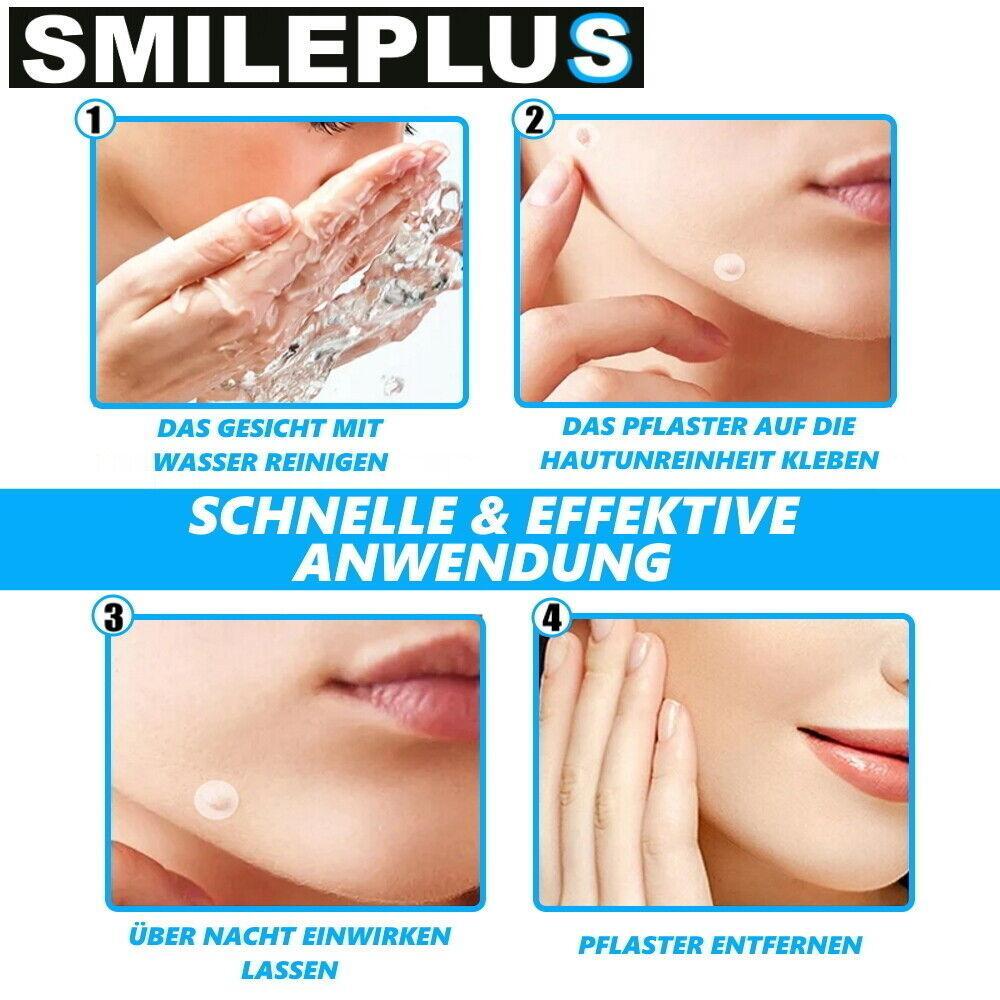 SMILEPLUS XXL Akne Pflaster Set Hydrocolloid Patch Anti Pickel Mitesser 36Stk