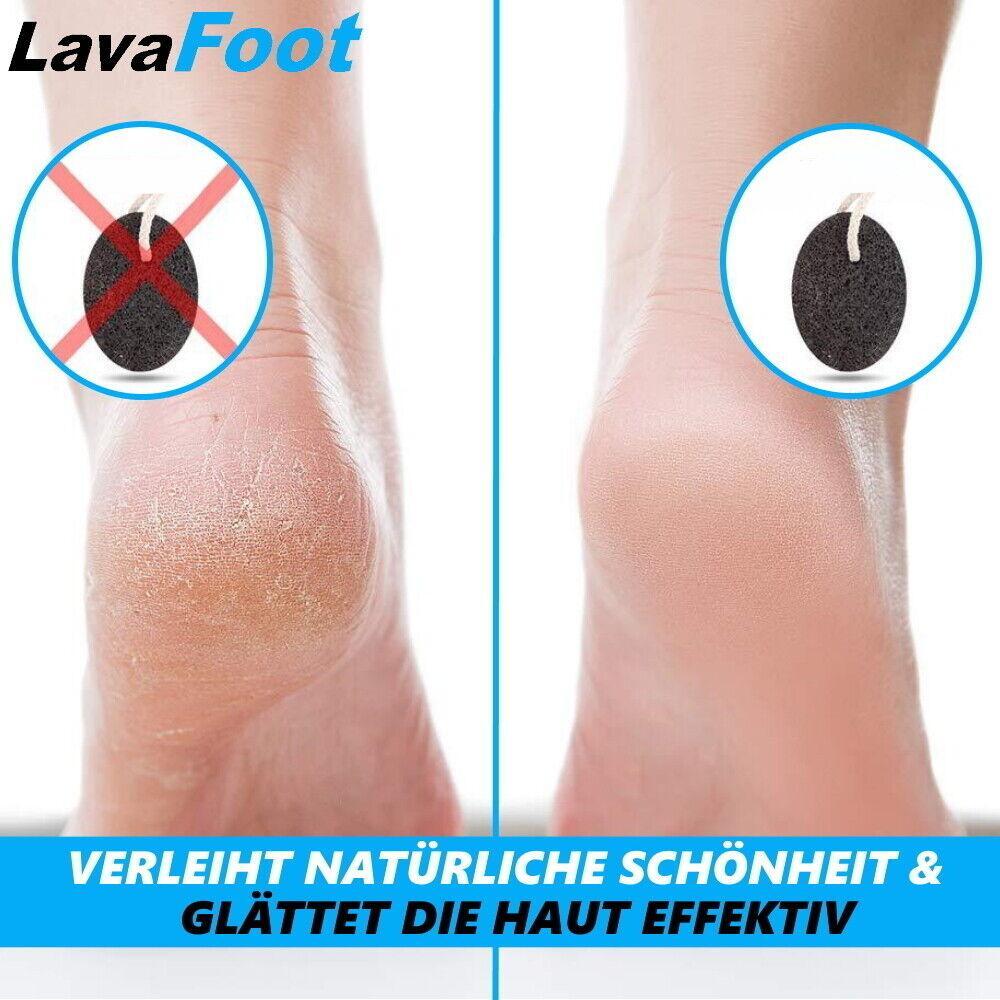 LavaFoot Lavastein Hornhautentferner Hornhauthobel Die alternative zu Bimsstein