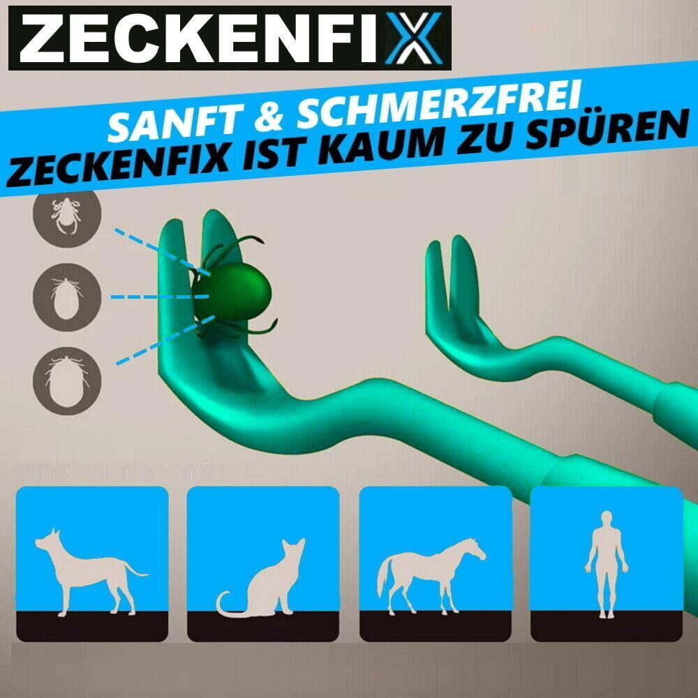 ZECKENFIX Zeckenzange Hunde Katze Zeckenpinzette Zeckenentferner Zeckenhaken Set