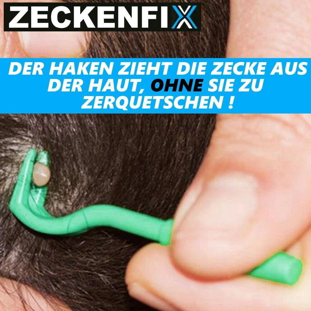 ZECKENFIX Zeckenzange Hunde Katze Zeckenpinzette Zeckenentferner Zeckenhaken Set