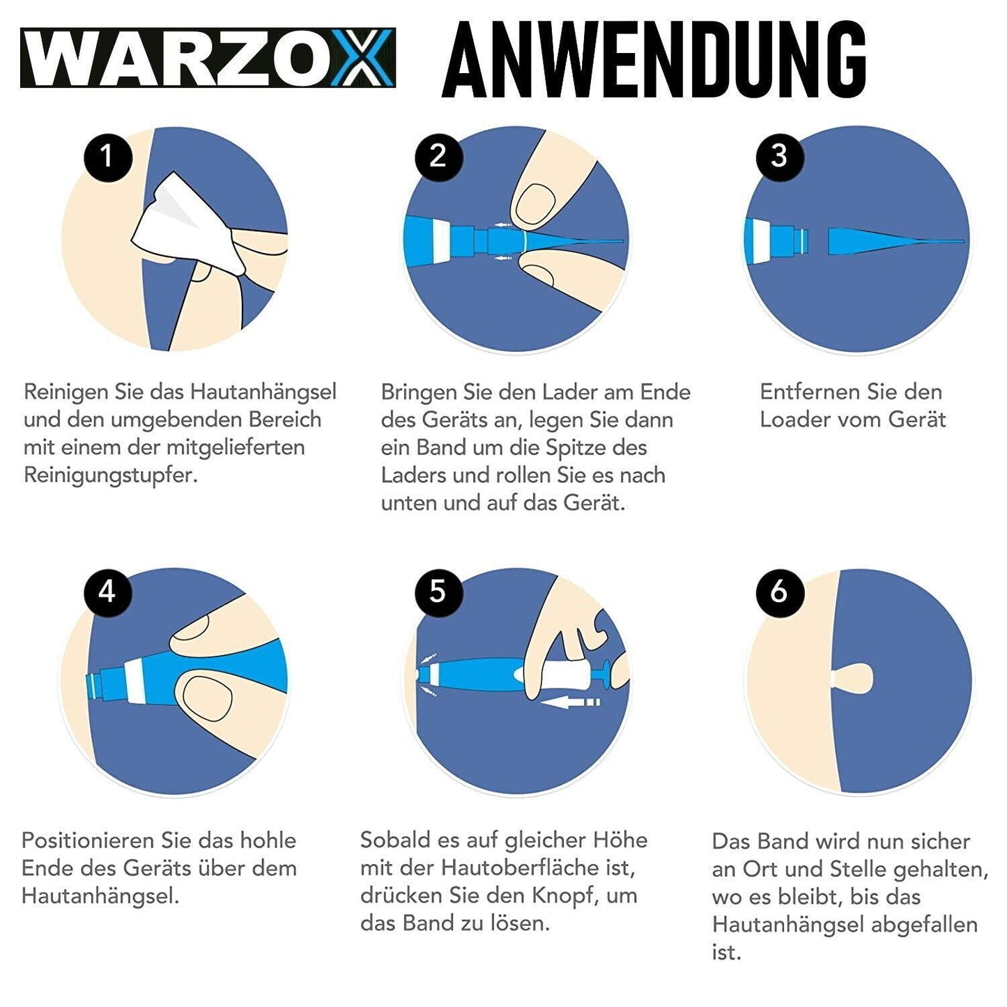 WARZOX Skin Tag Remover Kit Stielwarzen Set Fibrom Kosmetik Entferner 54tlg