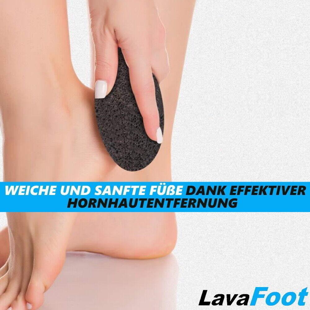 LavaFoot Lavastein Hornhautentferner Hornhauthobel Die alternative zu Bimsstein