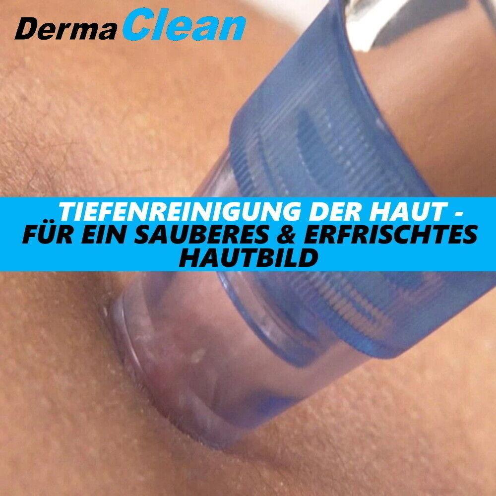 DermaClean Mitesser Entferner Sauger Pickel Akne Komedo Porenreiniger aus TV