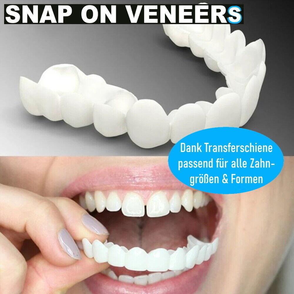 Snap On Veneers Kosmetische Zahnblende Comfort Prothese Falsche Zähne Flex Fit