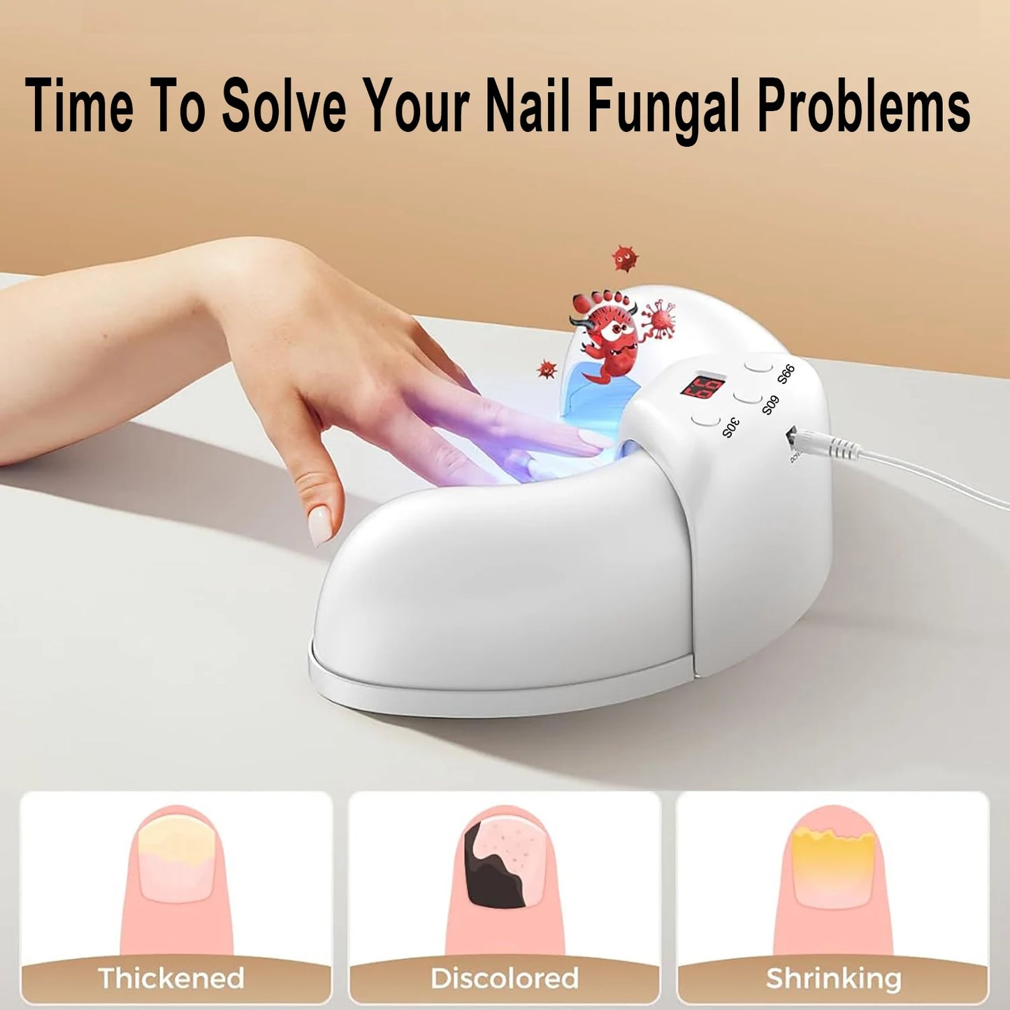 Nagelpilz Laser Gerät Anti Pilz Behandlung Fußnagel Fingernagel Paronychie Therapie