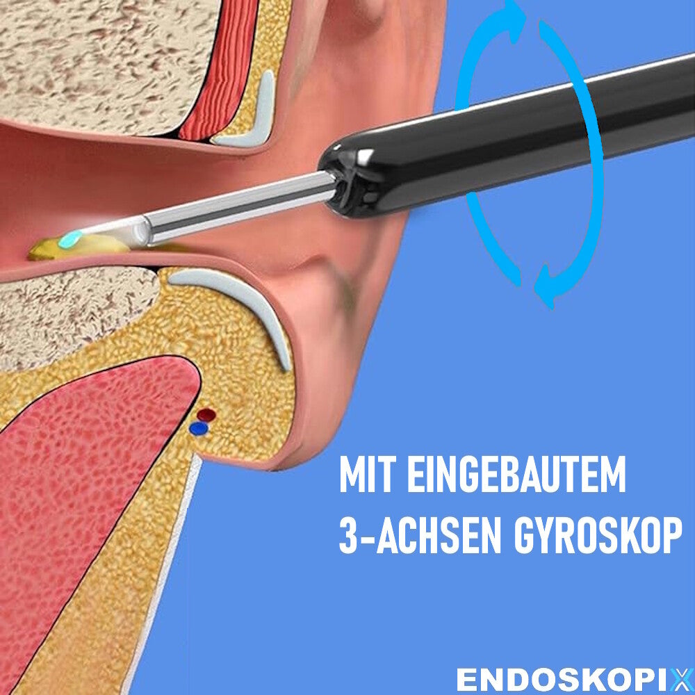 ENDOSKOPIX Elektrischer Ohrenreiniger Kamera Ohr Reinigung Ohrenschmalz