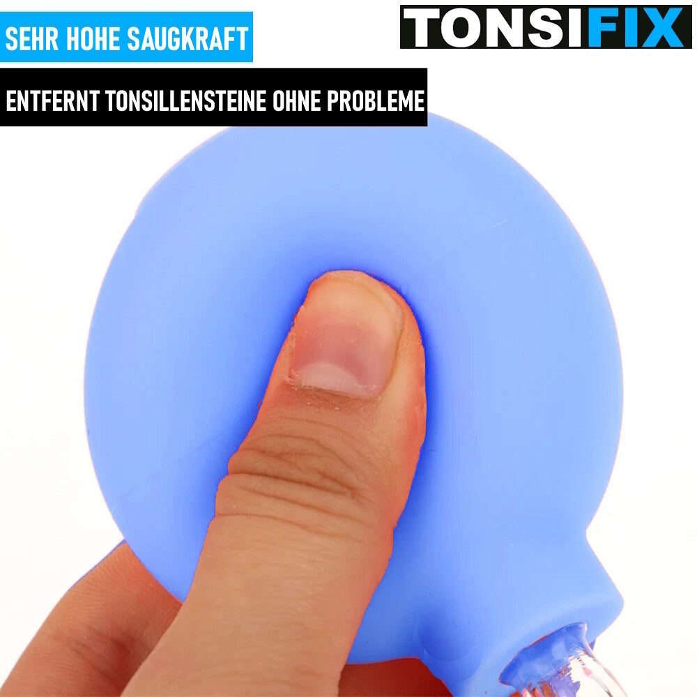 TONSIFIX Tonsillensteinentferner Mandelstein Entferner Mandelsauger Schröpfglas